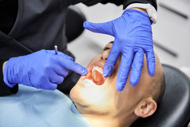 Best Emergency Gum Treatment in Blue Ash, OH