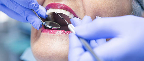 Best Urgent Care for Lost Fillings or Crowns in Blue Ash, OH